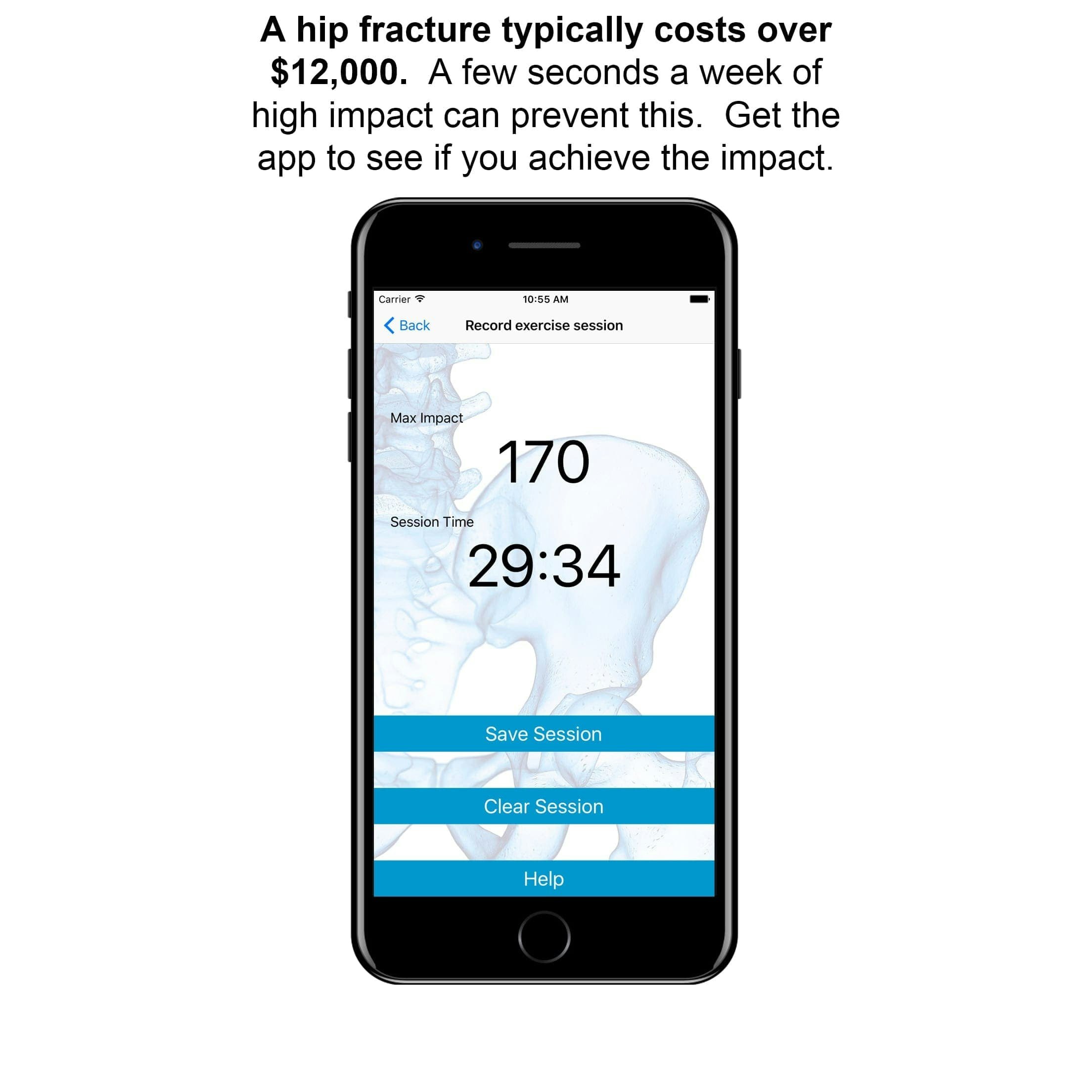 Fractureproof iOS App
